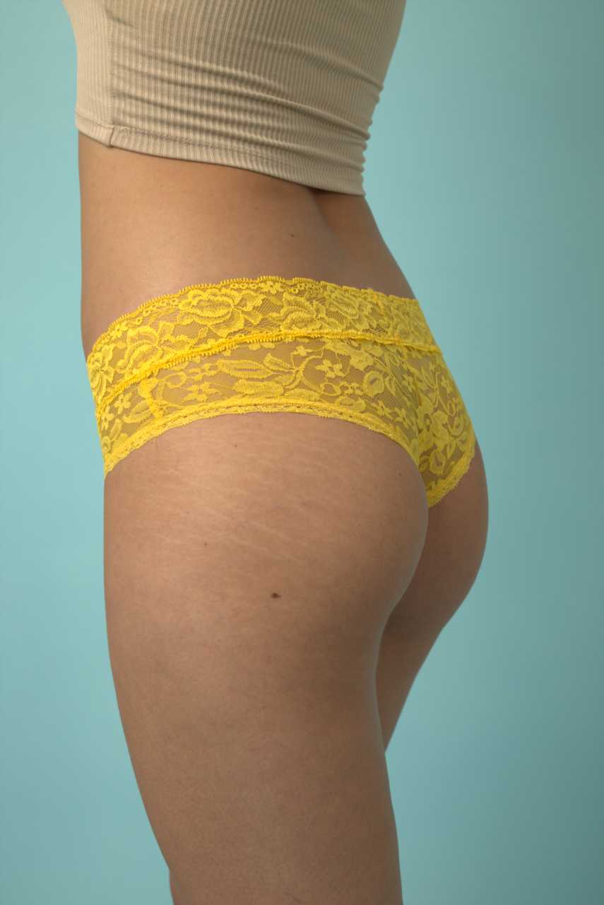 CALZÓN TIPO HIPSTER ENCAJE AMARILLO